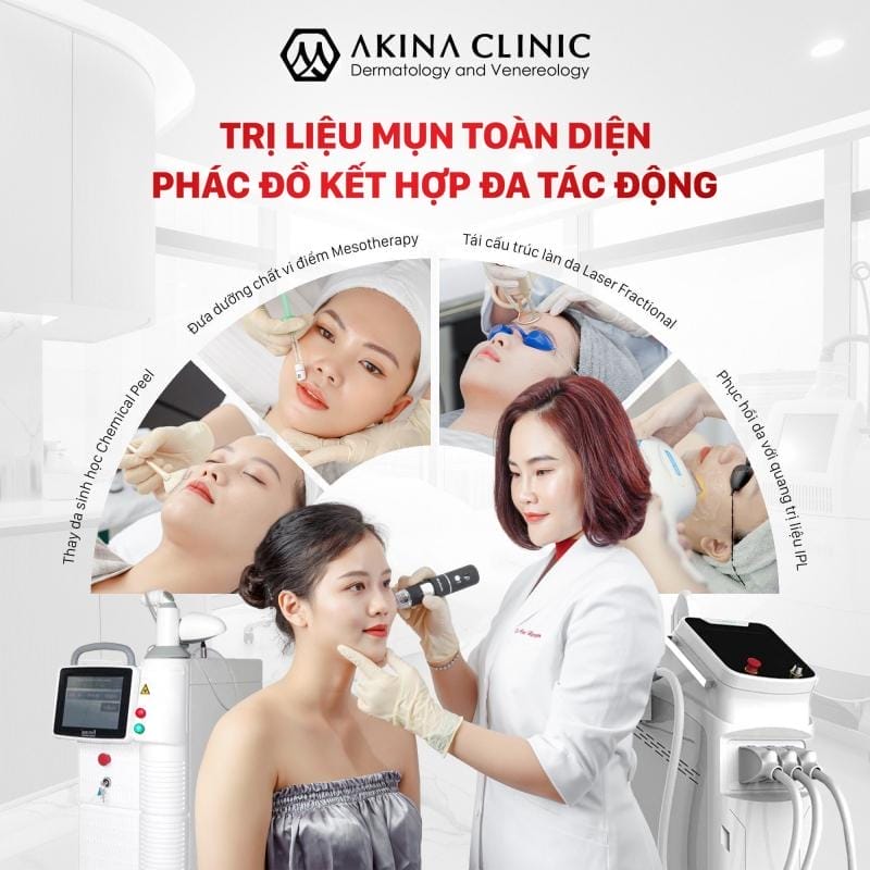 Phòng khám da liễu AKINA Acne Đà Nẵng - BS Cao Nguyên